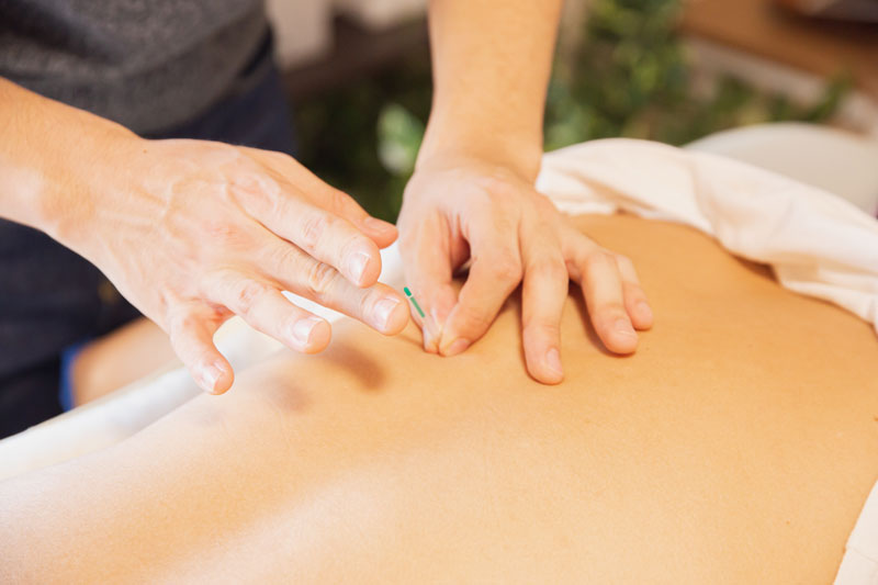 Offers Acupuncture